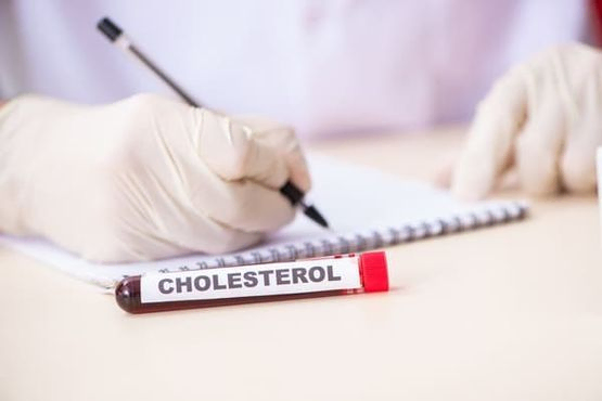 Análisis de colesterol